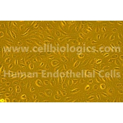 Human Primary Ovarian Microvascular Endothelial Cells